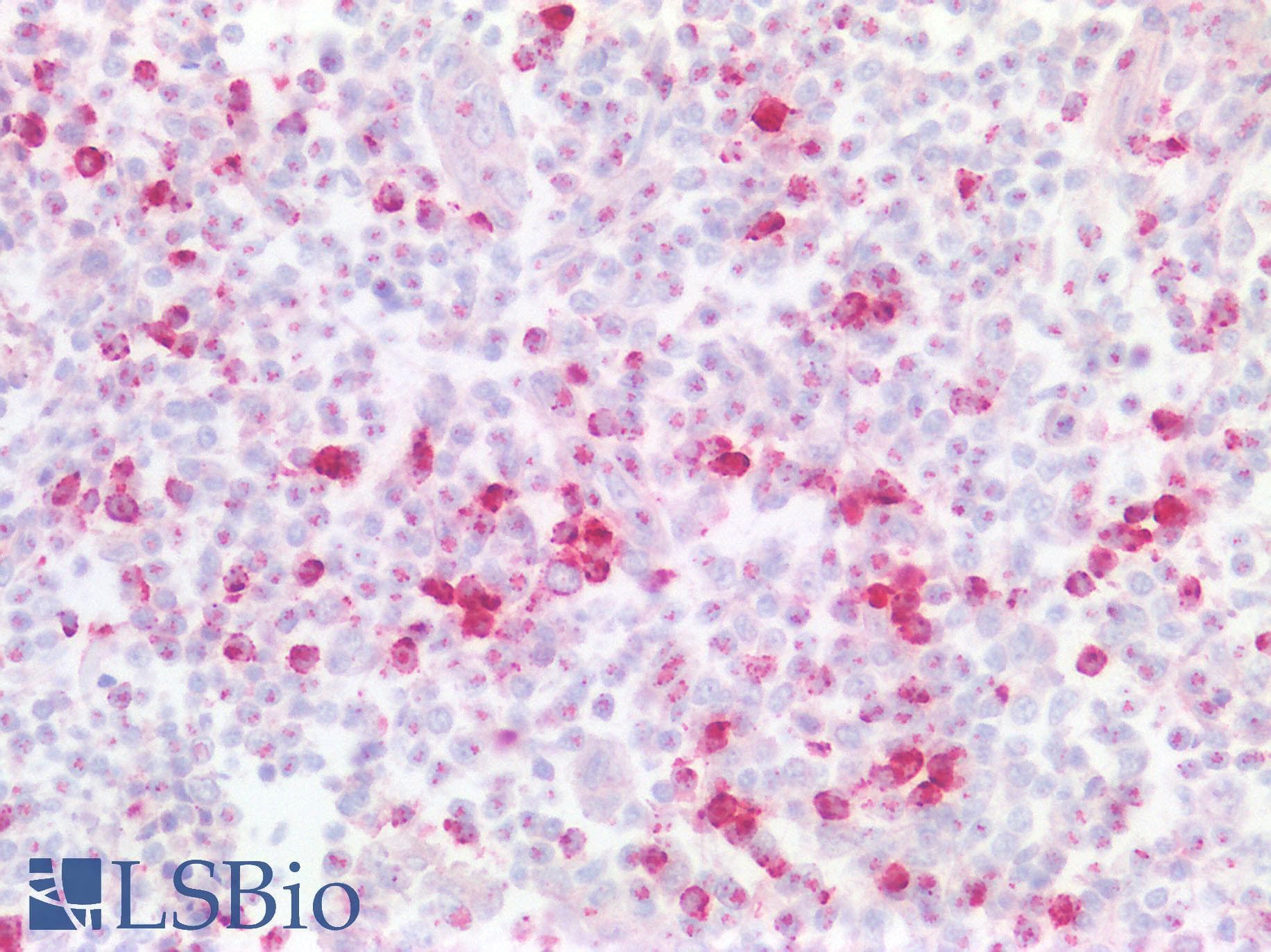 Polyclonal Rabbit anti-Human GZMK / Granzyme K Antibody (IHC, IF)