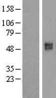 SLC26A11 Protein (Over-Expression Lysate Myc-DDK (Flag))