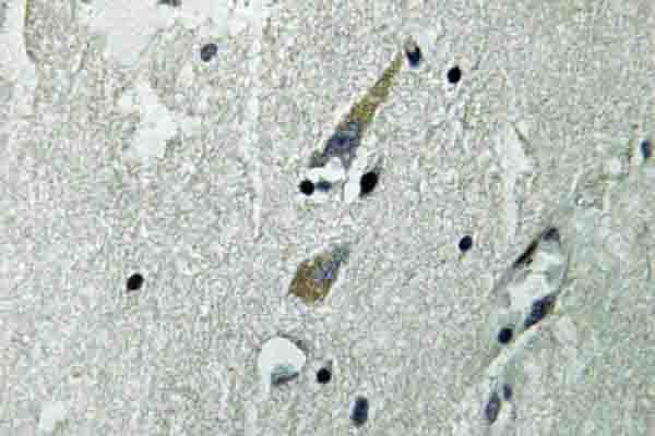 RAF1 / RAF Antibody (Arg282)