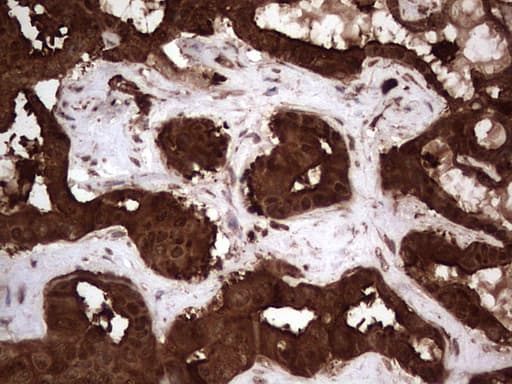 LGALS3 / Galectin 3 Antibody (clone OTI6E1, Carrier-free)
