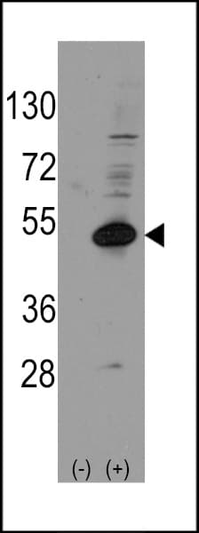 IHC-plus™ NR0B1 / DAX1 Antibody (aa304-333)