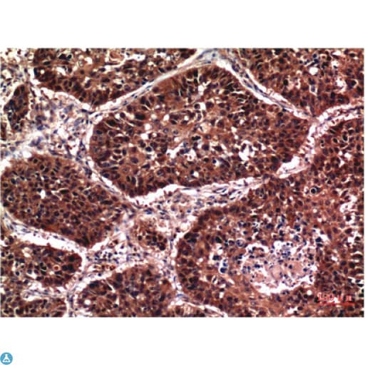 AKT1 Antibody
