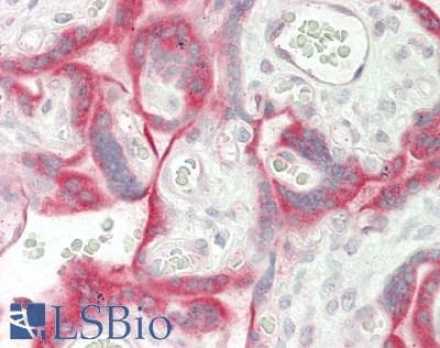 IHC-plus™ SLC15A1 / PEPT1 Antibody (aa225-274)