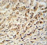 AVL9 Antibody (aa619-648)