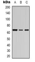 Polyclonal Rabbit anti-Human ER Alpha / Estrogen Receptor Antibody (Internal, IHC, IF, WB)