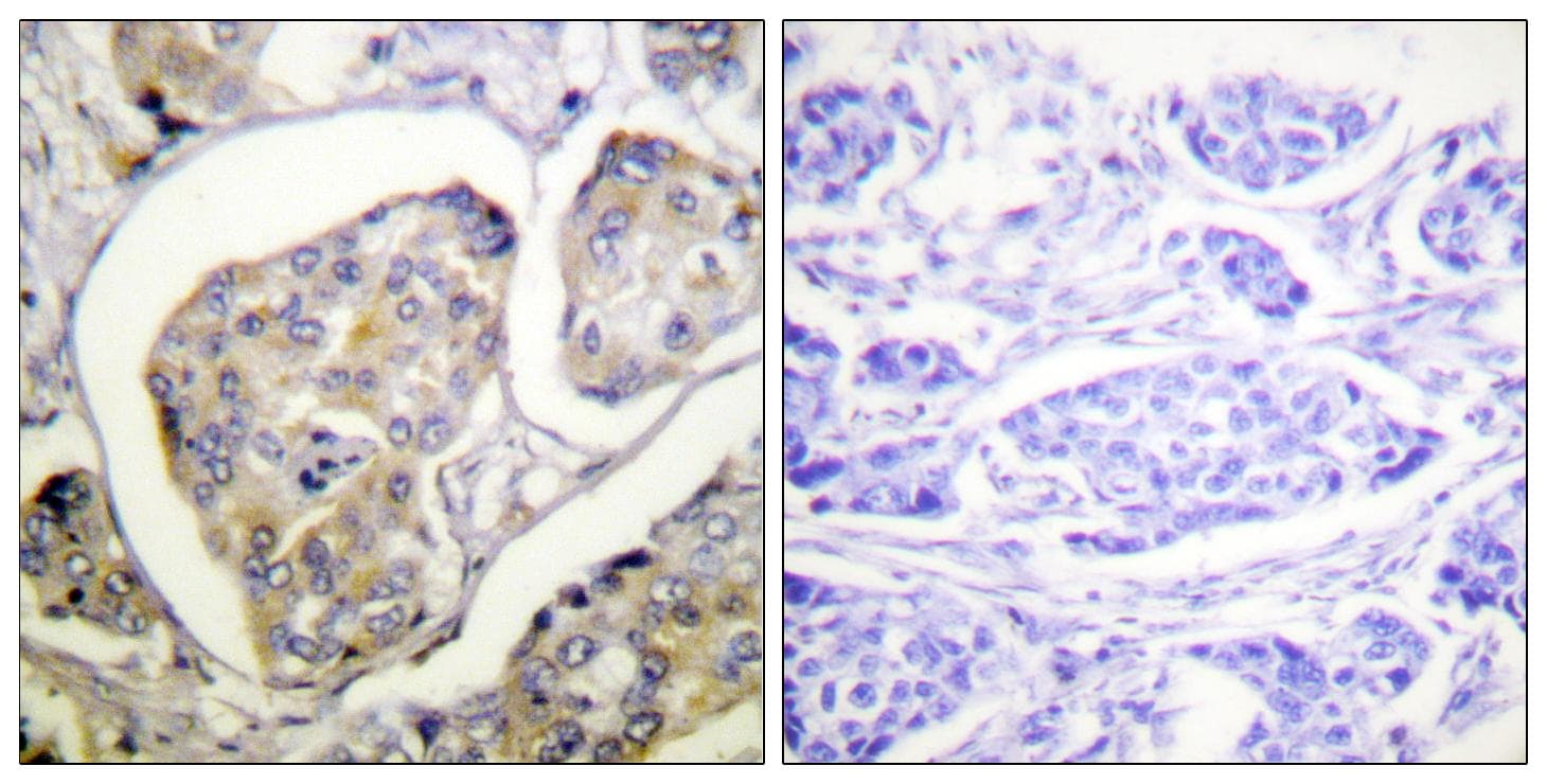FAK / Focal Adhesion Kinase Antibody (p397)