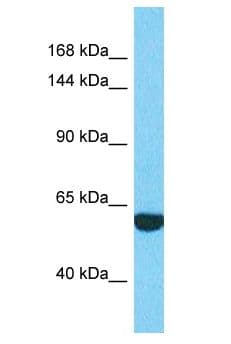 Polyclonal Rabbit anti-Human EXOC2 / SEC5 Antibody (aa406-455, WB)
