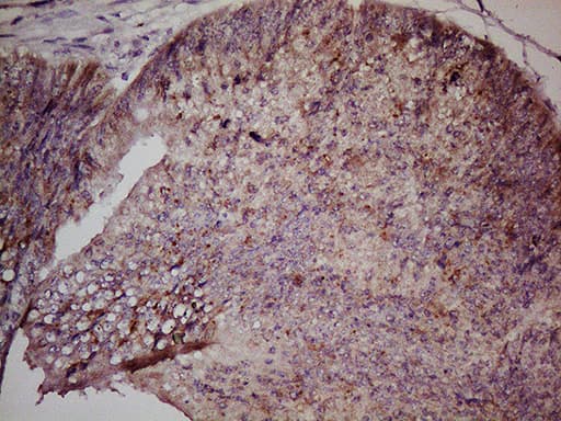 GPR49 / LGR5 Antibody (aa22-543, clone UMAB211)