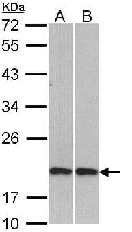 Polyclonal Rabbit anti-Human CFL2 / Cofilin 2 Antibody (aa1-166, WB)