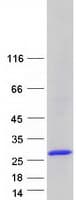 Human ARHGDIA / RHOGDI Protein (Recombinant Myc-DDK (Flag))