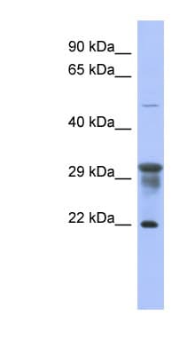PMM1 Antibody (N-Terminus)