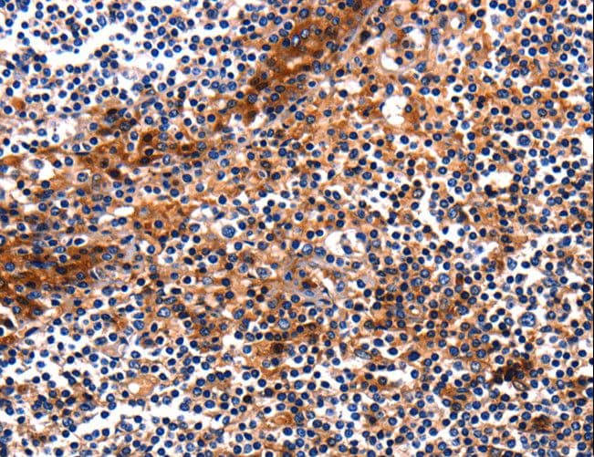 HP / Haptoglobin Antibody
