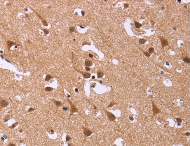 IHC-plus™ DCBLD2 Antibody