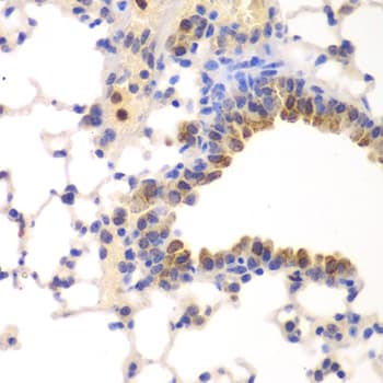 NFKB1 / NF-Kappa-B Antibody