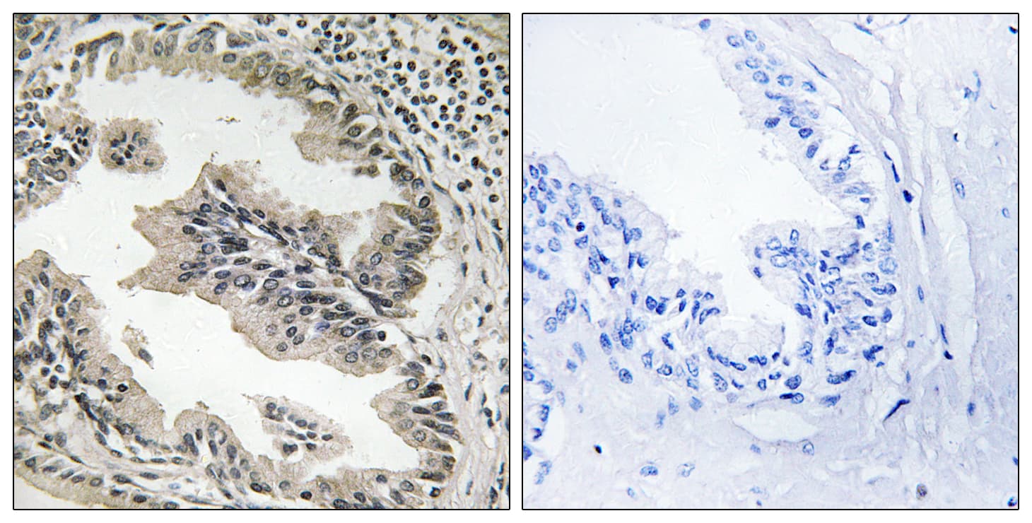 SH3GLB2 / Endophilin-B2 Antibody (aa131-180)
