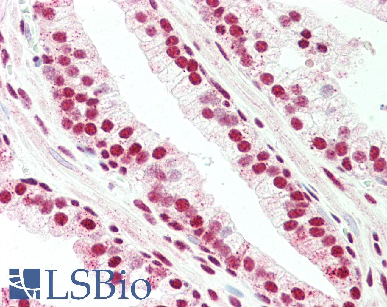 IHC-plus™ BLIMP1 / PRDM1 Antibody (C-Terminus)