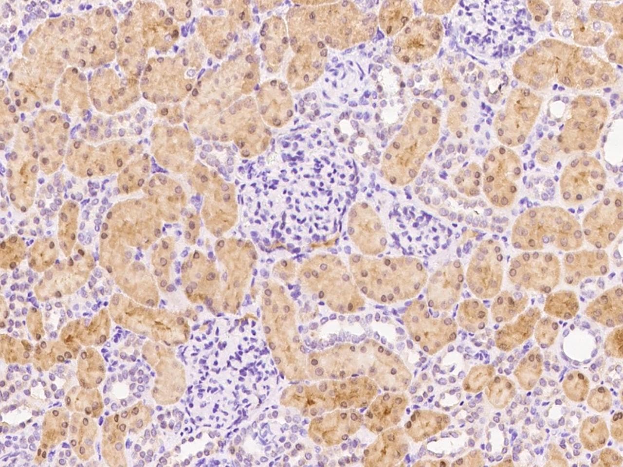 Polyclonal Rabbit anti-Human FUOM / C10orf125 Antibody (Preservative Free, IHC)