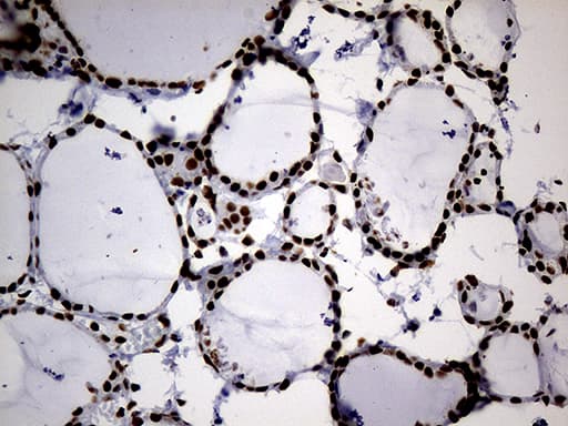 HNRNPH1 / hnRNP H Antibody (clone OTI4F10)