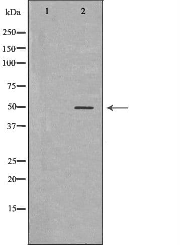 Polyclonal Rabbit anti-Human CARD8 / Cardinal / TUCAN Antibody (IHC, WB)