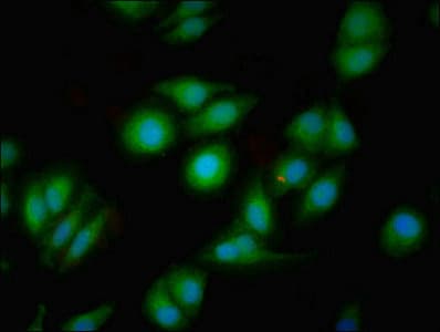 DRD1 / Dopamine Receptor D1 Antibody