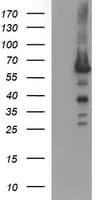TH / Tyrosine Hydroxylase Antibody (clone OTI3A7)