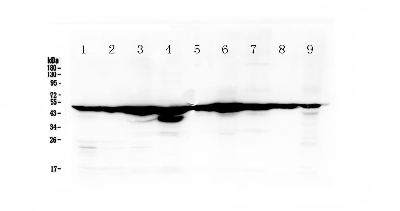 Polyclonal Rabbit anti-Human FH / Fumarase / MCL Antibody (IHC, WB)