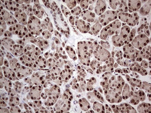 PCNA Antibody (clone OTI13G4)