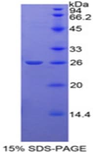 Rat Beta-N-Acetylglucosaminidase Protein (Recombinant His)