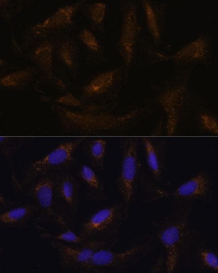 SLC25A27 / UCP4 Antibody