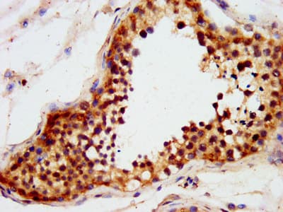 LIN41 / TRIM71 Antibody