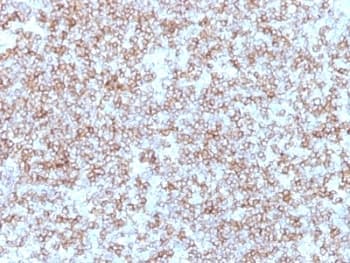 HLA-DR Antibody (clone Bra-14)