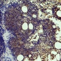 HIST1H3H Antibody