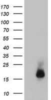 CST3 / Cystatin C Antibody (clone OTI7B8)