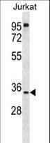 Polyclonal Rabbit anti-Human UBXD6 Antibody (aa59-87, WB)