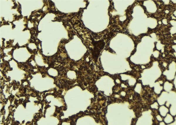 Polyclonal Rabbit anti-Human OGG1 Antibody (IHC, WB)