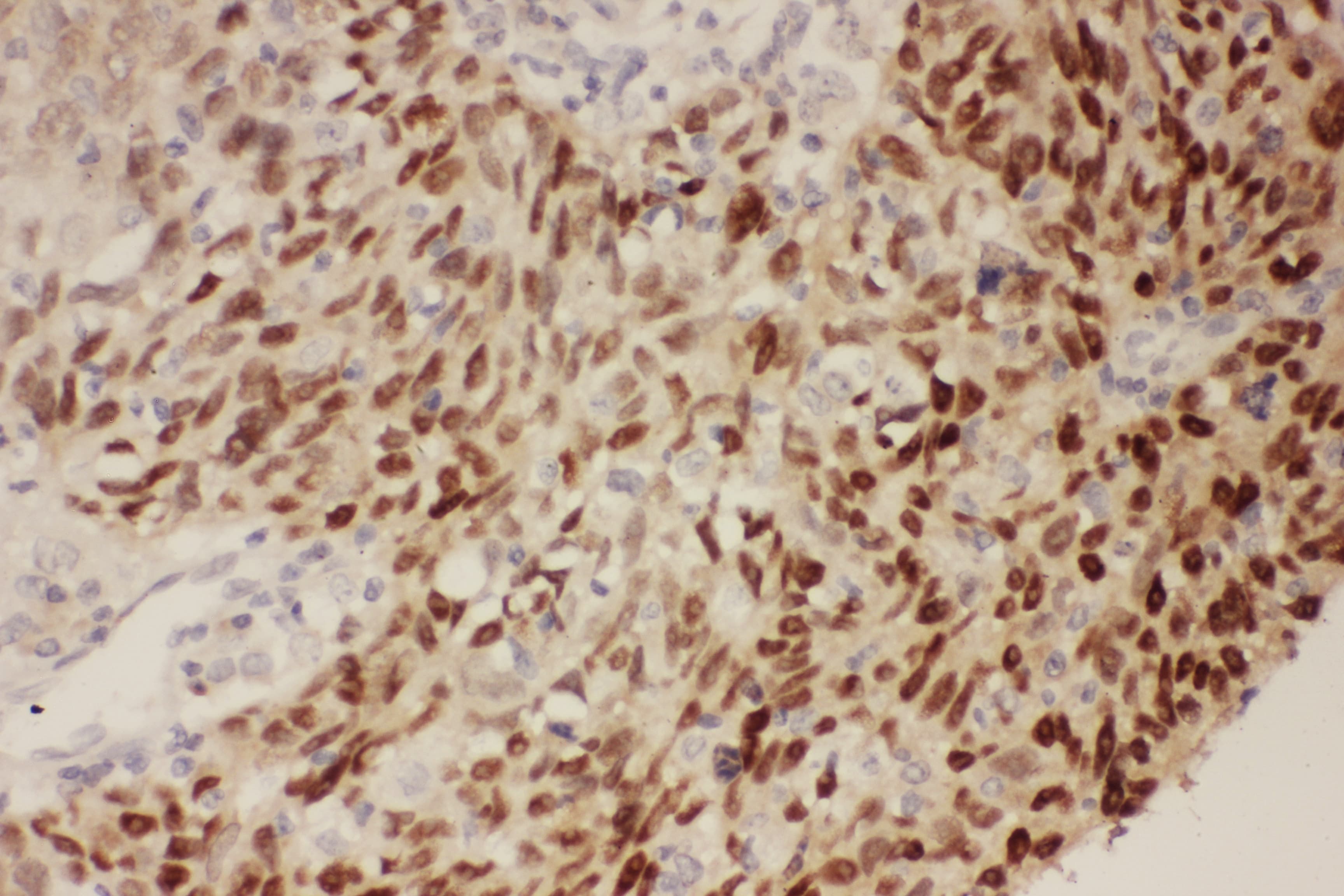 Polyclonal Rabbit anti-Human TP53 / p53 Antibody (aa74-393, IHC, WB)