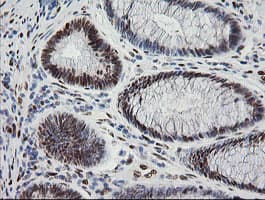 ZSCAN18 / ZNF447 Antibody (clone OTI1F10)