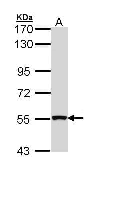 IHC-plus™ Polyclonal Rabbit anti-Human REL / C-Rel Antibody (IHC, WB)