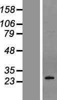 PDPN / Podoplanin Protein (Over-Expression Lysate Myc-DDK (Flag))