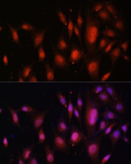 TFEB Antibody