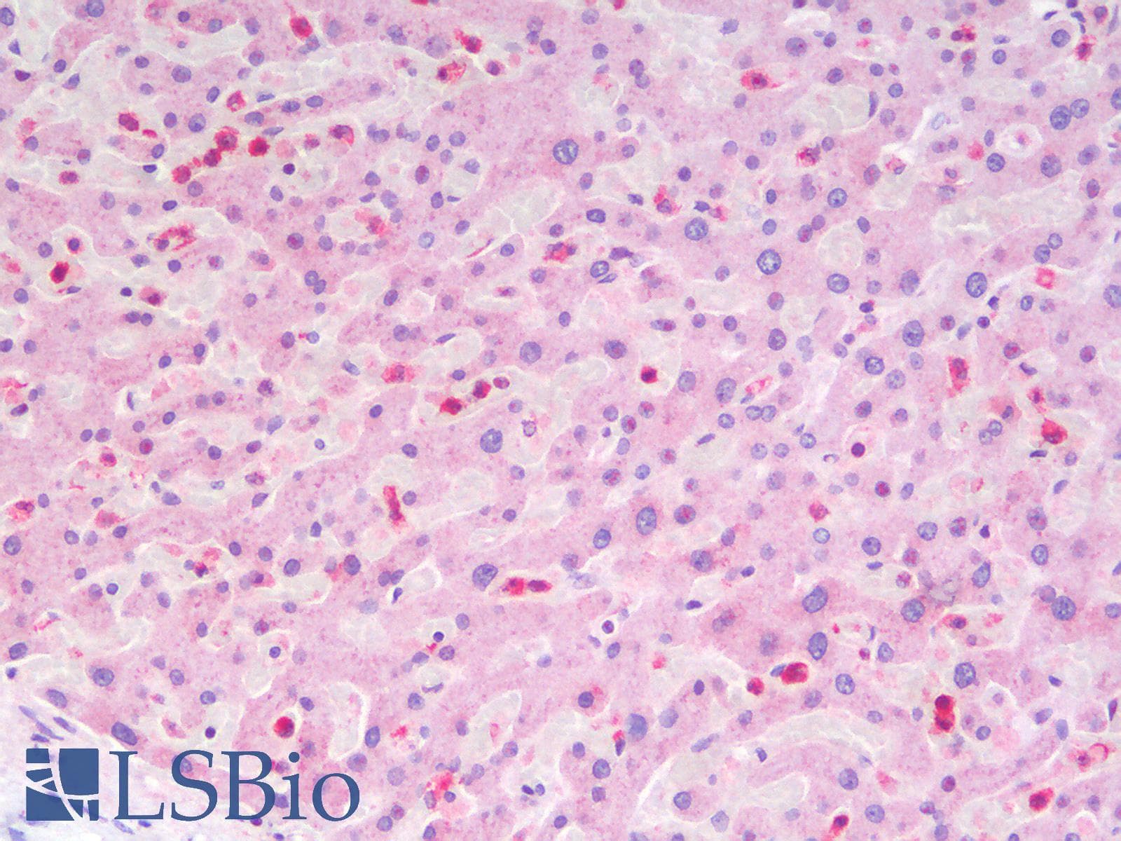 PathPlus™ ITGAX / CD11c Antibody