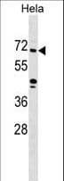 ZNF280B Antibody (aa60-89)