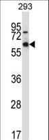 MEF2D Antibody (aa251-279)