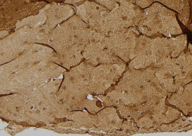 Polyclonal Rabbit anti-Human ULK3 Antibody (IHC, IF, WB)
