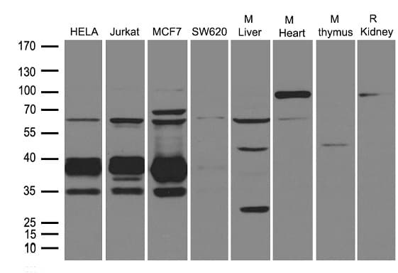 UNG / Uracil DNA Glycosylase Antibody
