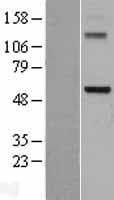 DDX28 Protein (Over-Expression Lysate Myc-DDK (Flag))
