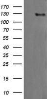 Monoclonal Mouse anti-Human ERBB2 / HER2 Antibody (clone OTI2G9, Carrier-free, aa676-1255, WB)