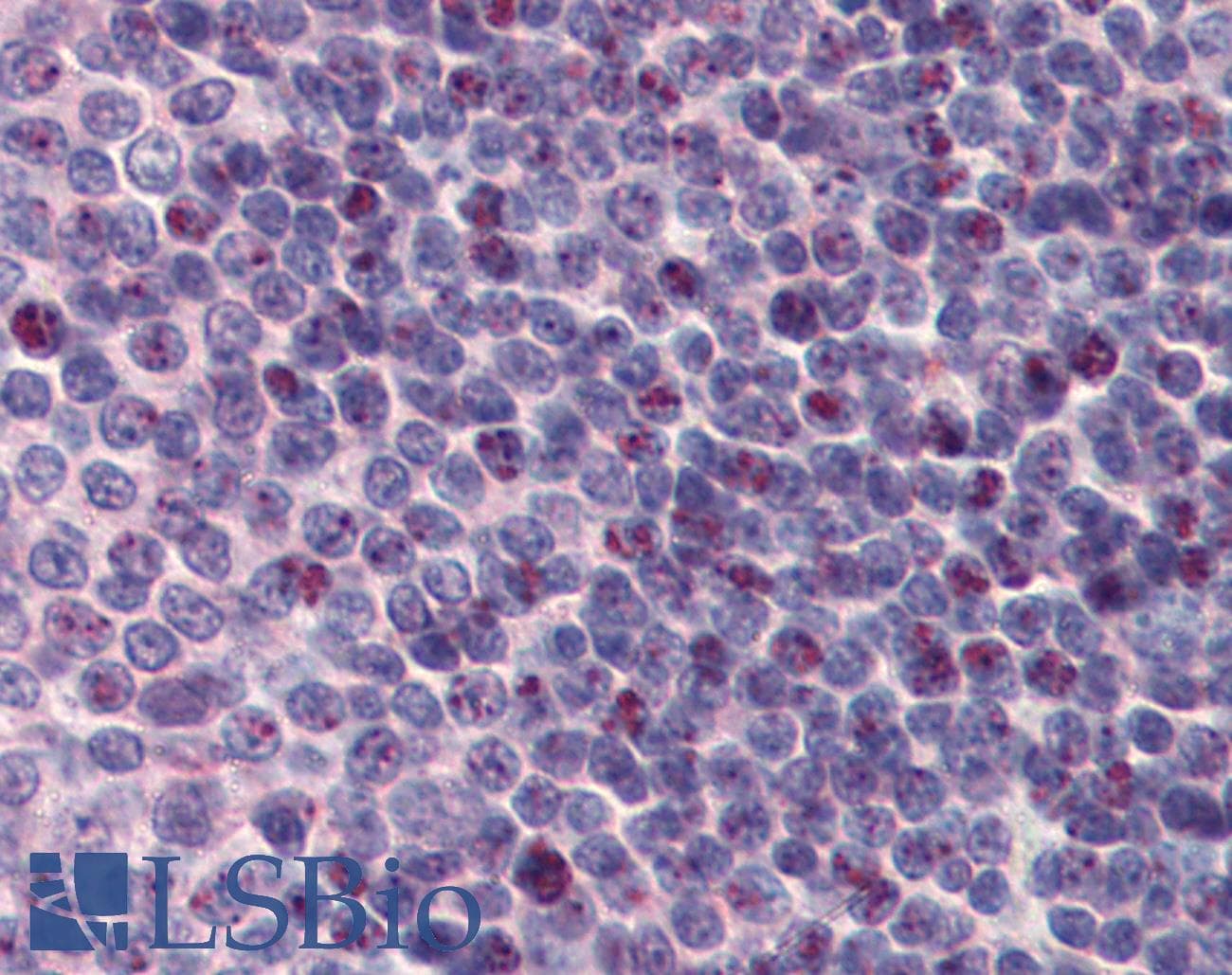 HnRNP-E1 / PCBP1 Antibody (aa208-257)