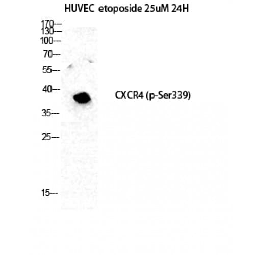 Polyclonal Rabbit anti-Human CXCR4 Antibody (280-360 aa, IHC, IF, WB)