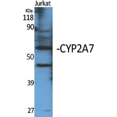 Polyclonal Rabbit anti-Human CYP2A7 Antibody (C-terminal, IHC, WB)